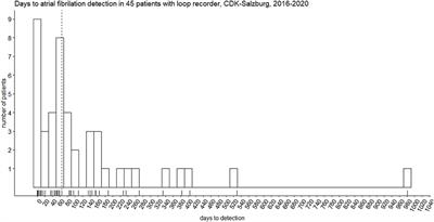 Neurologist-Led Management of Implantable Loop-Recorders After Embolic Stroke of Undetermined Source